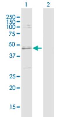 Western Blot: SLC25A31 Antibody [H00083447-D01P]