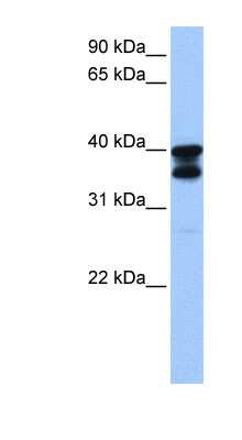 Western Blot: SLC25A31 Antibody [NBP1-59561]