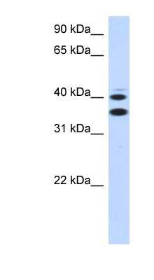 Western Blot: SLC25A32 Antibody [NBP1-59566]