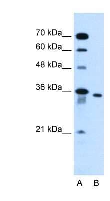 Western Blot: SLC25A32 Antibody [NBP1-59583]