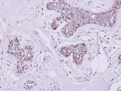 Immunohistochemistry-Paraffin: SLC25A33 Antibody [NBP1-32499]