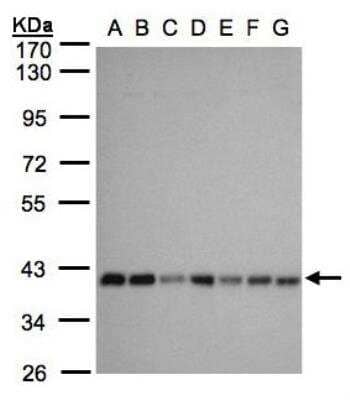 Western Blot: SLC25A33 Antibody [NBP1-32499]