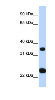 Western Blot: SLC25A35 Antibody [NBP1-59606]