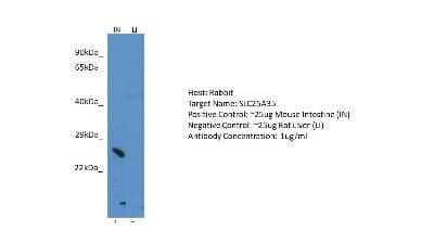 Western Blot: SLC25A35 Antibody [NBP2-85742]