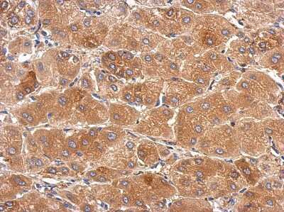 Immunohistochemistry-Paraffin: SLC25A36 Antibody [NBP2-20391]