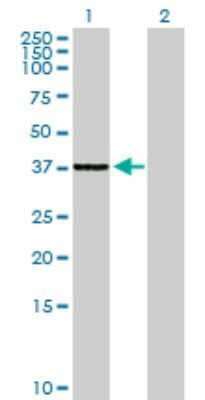 Western Blot: SLC25A36 Antibody [H00055186-B01P]