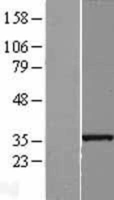 Western Blot: SLC25A36 Overexpression Lysate [NBL1-16064]