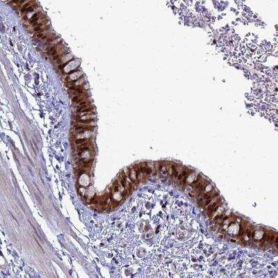 Immunohistochemistry-Paraffin: SLC25A37 Antibody [NBP1-93525]