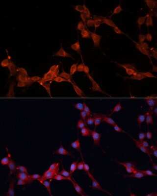 Immunocytochemistry/ Immunofluorescence: SLC25A38 Antibody - Azide and BSA Free [NBP2-93818]