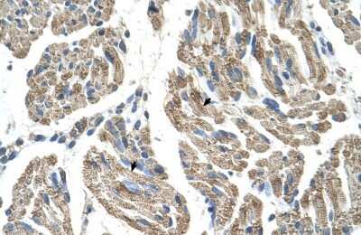 Immunohistochemistry-Paraffin: SLC25A38 Antibody [NBP1-59559]