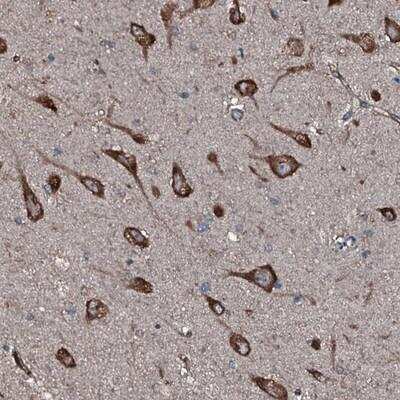 Immunohistochemistry-Paraffin: SLC25A38 Antibody [NBP1-83646]