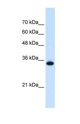 Western Blot: SLC25A38 Antibody [NBP1-59559]