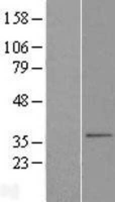 Western Blot: SLC25A38 Overexpression Lysate [NBL1-16065]