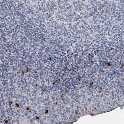 Immunohistochemistry-Paraffin: SLC25A39 Antibody [NBP1-84502]