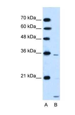 Western Blot: SLC25A39 Antibody [NBP1-59600]