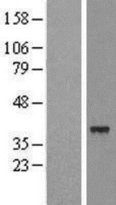 Western Blot: SLC25A39 Overexpression Lysate [NBL1-16066]