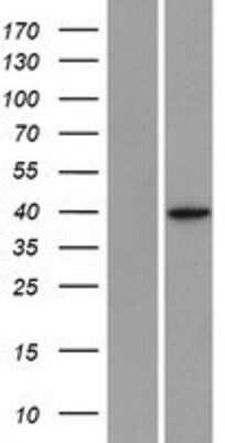 Western Blot: SLC25A39 Overexpression Lysate [NBP2-09681]