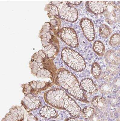 Immunohistochemistry-Paraffin: SLC25A40 Antibody [NBP2-30976]