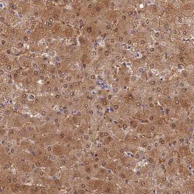 Immunohistochemistry-Paraffin: SLC25A41 Antibody [NBP1-93778]