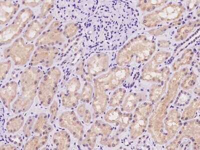 Immunohistochemistry-Paraffin: SLC25A41 Antibody [NBP2-98610]