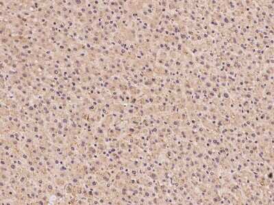 Immunohistochemistry-Paraffin: SLC25A41 Antibody [NBP2-98610]