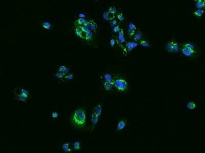 Immunocytochemistry/ Immunofluorescence: SLC25A42 Antibody [NBP2-98611]