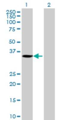 Western Blot: SLC25A42 Antibody [H00284439-B01P]