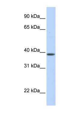 Western Blot: SLC25A42 Antibody [NBP1-59605]