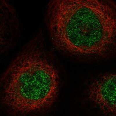 Immunocytochemistry/ Immunofluorescence: SLC25A43 Antibody [NBP1-86310]