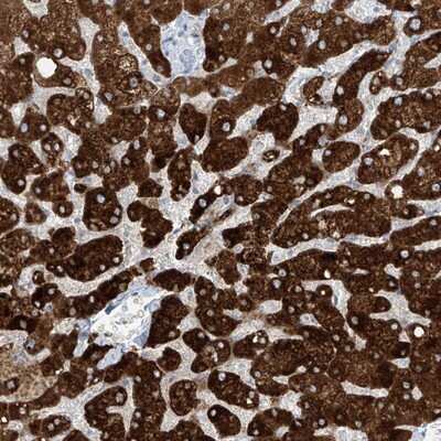 Immunohistochemistry-Paraffin: SLC25A43 Antibody [NBP1-86310]