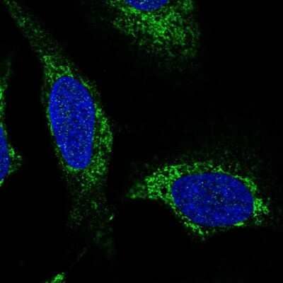 Immunocytochemistry/ Immunofluorescence: SLC25A44 Antibody [NBP2-56950]