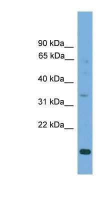 Western Blot: SLC25A44 Antibody [NBP1-80527]