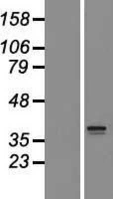 Western Blot: SLC25A44 Overexpression Lysate [NBL1-16070]