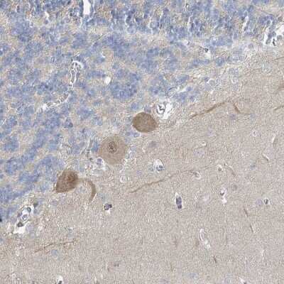 Immunohistochemistry-Paraffin: SLC25A45 Antibody [NBP2-30521]