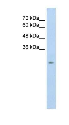 Western Blot: SLC25A45 Antibody [NBP1-59876]