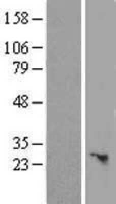 Western Blot: SLC25A45 Overexpression Lysate [NBL1-16071]