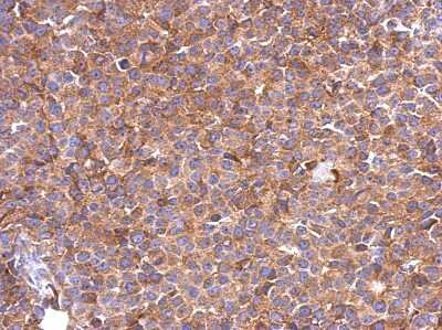 Immunohistochemistry-Paraffin: SLC25A46 Antibody [NBP2-20392]