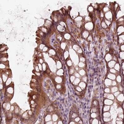 Immunohistochemistry-Paraffin: SLC25A46 Antibody [NBP2-57347]