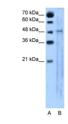 Western Blot: SLC25A46 Antibody [NBP1-59565]