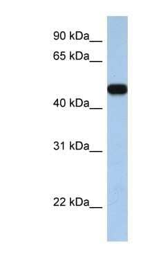 Western Blot: SLC25A46 Antibody [NBP1-59604]