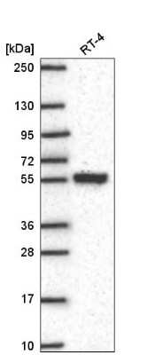 Western Blot: SLC25A46 Antibody [NBP2-57347]