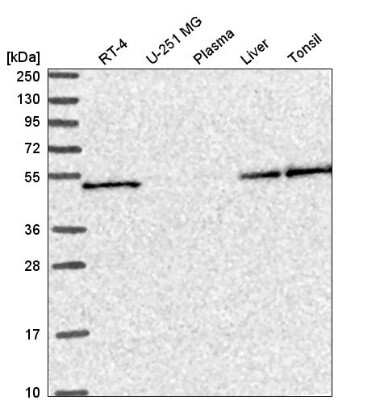 Western Blot: SLC25A46 Antibody [NBP2-58085]