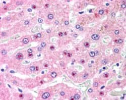 Immunohistochemistry-Paraffin: SLC25A47 Antibody [NB100-57843]