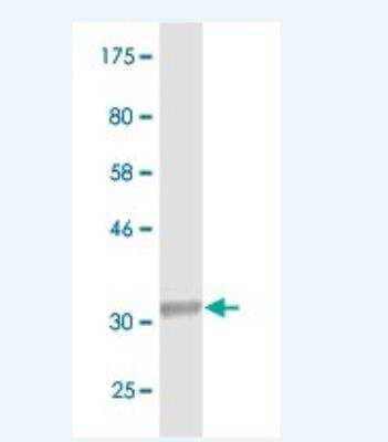 Western Blot: SLC25A6 Antibody (4B9) [H00000293-M02]