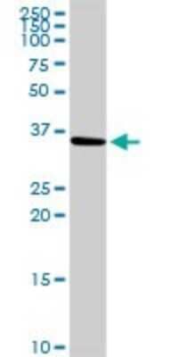 Western Blot: SLC25A6 Antibody [H00000293-D01P]