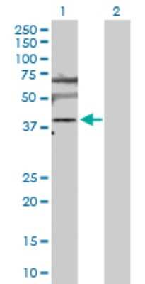 Western Blot: SLC25A6 Antibody [H00000293-D01P]