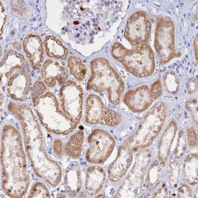 Immunohistochemistry-Paraffin: SLC26A1 Antibody [NBP1-84897]