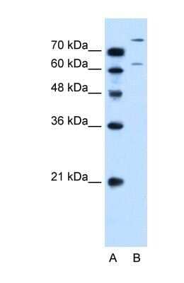 Western Blot: SLC26A1 Antibody [NBP1-59408]