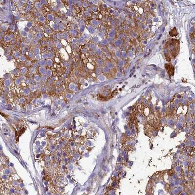 Immunohistochemistry-Paraffin: SLC26A10 Antibody [NBP1-92400]