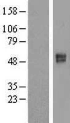 Western Blot: SLC26A11 Overexpression Lysate [NBL1-16075]